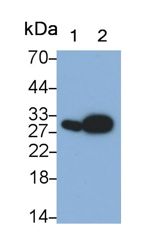Neutrophil gelatinase-associated lipocalin (NGAL) Rat Monoclonal Antibody
