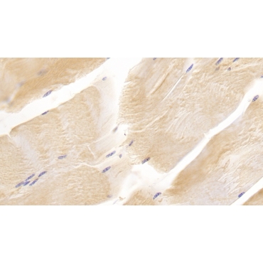 Cluster of Differentiation 90 (CD90) Human Monoclonal Antibody