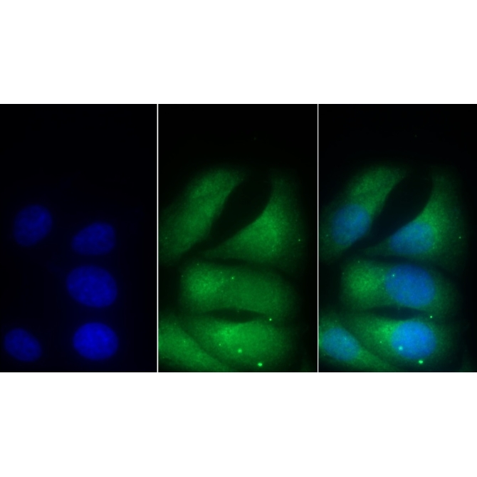 Cluster of Differentiation 90 (CD90) Human Monoclonal Antibody