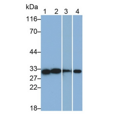 Cluster of Differentiation 90 (CD90) Human Monoclonal Antibody