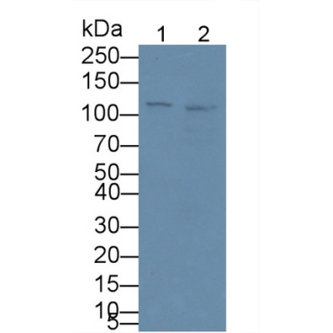 Complement Component 1, Q Receptor (C1qR1) Human Monoclonal Antibody