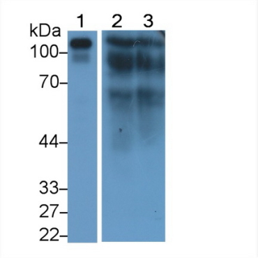 Complement Component 1, Q Receptor (C1qR1) Human Monoclonal Antibody