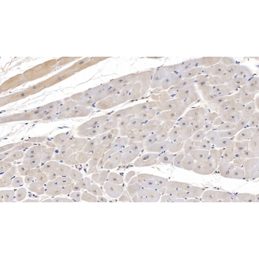Complement Component 1, Q Receptor (C1qR1) Human Monoclonal Antibody