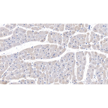 Complement Component 1, Q Receptor (C1qR1) Human Monoclonal Antibody