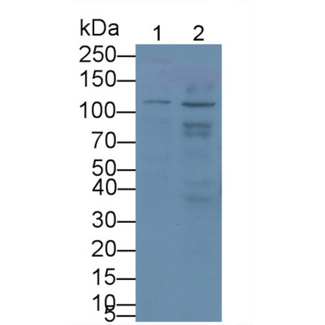 Complement Component 1, Q Receptor (C1qR1) Human Monoclonal Antibody