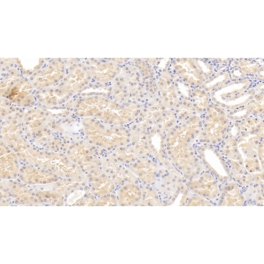 Lipopolysaccharide Binding Protein (LBP) Human Monoclonal Antibody