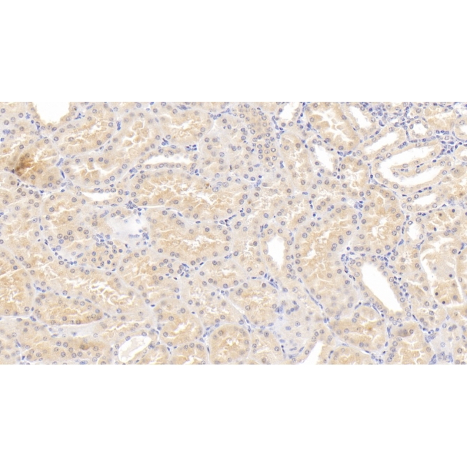 Lipopolysaccharide Binding Protein (LBP) Human Monoclonal Antibody