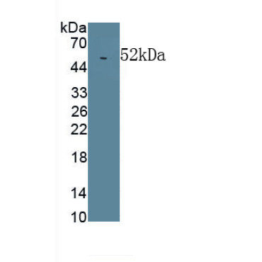 Lipopolysaccharide Binding Protein (LBP) Human Monoclonal Antibody