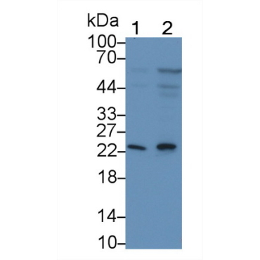 Killer Cell Lectin Like Receptor Subfamily D, Member 1 (KLRD1) Human Monoclonal Antibody