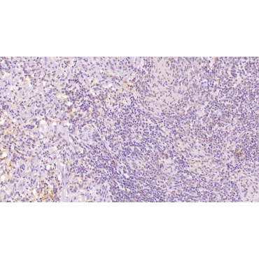Cluster Of Differentiation 97 (CD97) Human Monoclonal Antibody