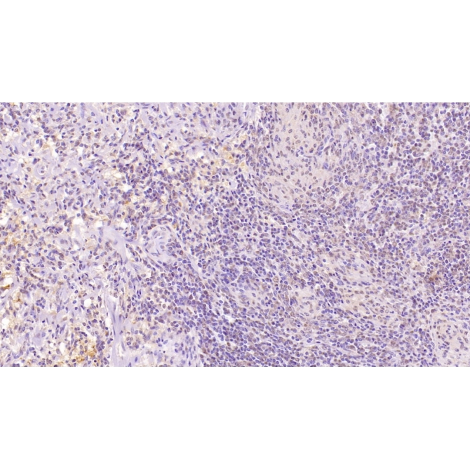 Cluster Of Differentiation 97 (CD97) Human Monoclonal Antibody