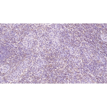 Cluster Of Differentiation 97 (CD97) Human Monoclonal Antibody