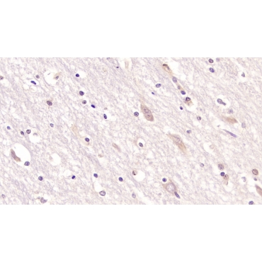 Cluster Of Differentiation 97 (CD97) Human Monoclonal Antibody