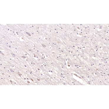 Cluster Of Differentiation 97 (CD97) Human Monoclonal Antibody