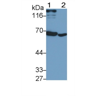 Interferon Alpha/Beta Receptor 1 (IFNa/bR1) Human Monoclonal Antibody