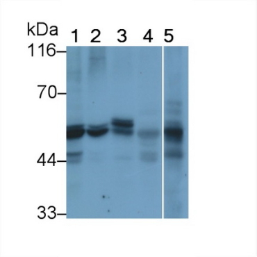 Interferon Alpha/Beta Receptor 1 (IFNa/bR1) Human Monoclonal Antibody