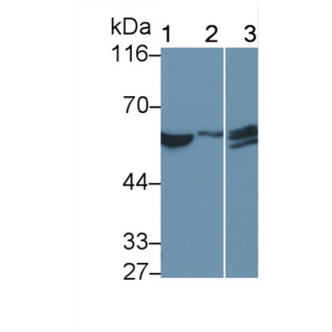 Interferon Alpha/Beta Receptor 1 (IFNa/bR1) Human Monoclonal Antibody
