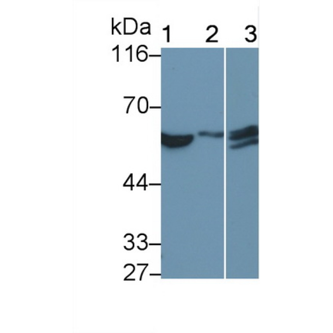 Interferon Alpha/Beta Receptor 1 (IFNa/bR1) Human Monoclonal Antibody