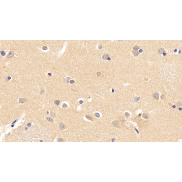 Interferon Alpha/Beta Receptor 1 (IFNa/bR1) Human Monoclonal Antibody