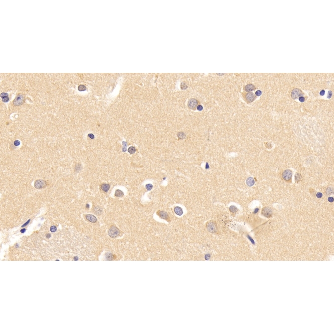 Interferon Alpha/Beta Receptor 1 (IFNa/bR1) Human Monoclonal Antibody