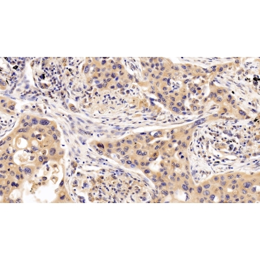 Interferon Alpha/Beta Receptor 1 (IFNa/bR1) Human Monoclonal Antibody