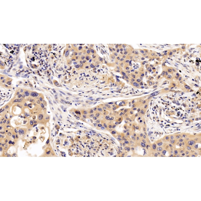 Interferon Alpha/Beta Receptor 1 (IFNa/bR1) Human Monoclonal Antibody