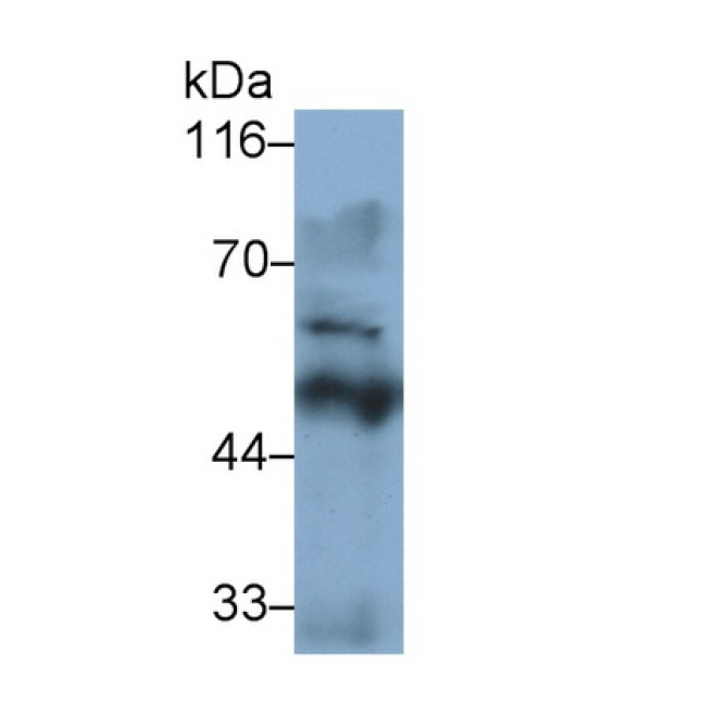 Tyrosine Hydroxylase (TH) Human Monoclonal Antibody