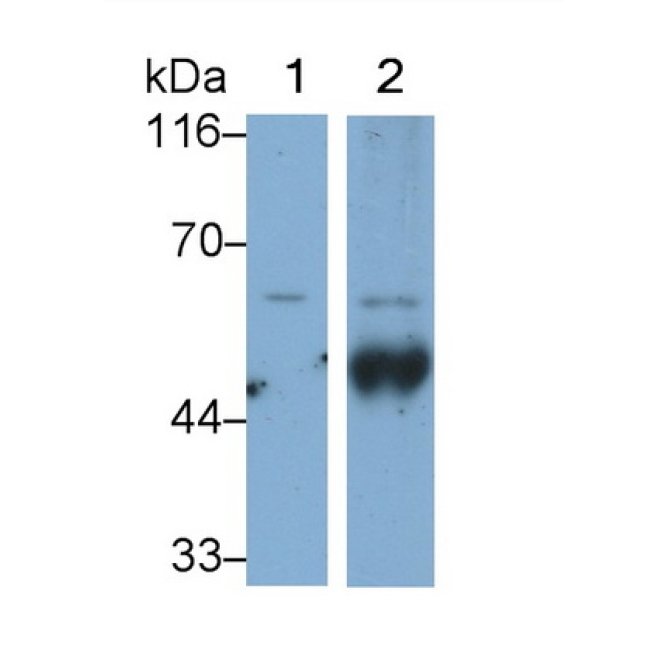 Tyrosine Hydroxylase (TH) Human Monoclonal Antibody