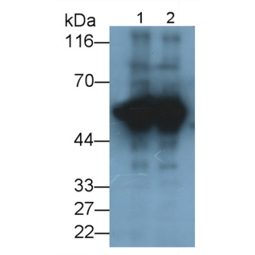 Tyrosine Hydroxylase (TH) Human Monoclonal Antibody