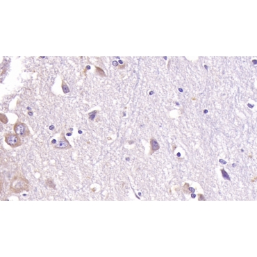 Acetylcholinesterase (ACHE) Human Monoclonal Antibody