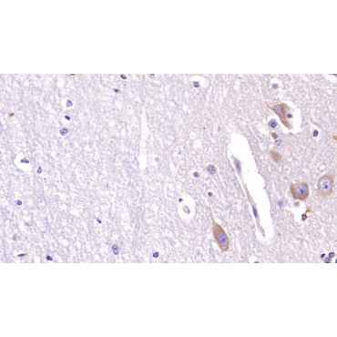 Acetylcholinesterase (ACHE) Human Monoclonal Antibody