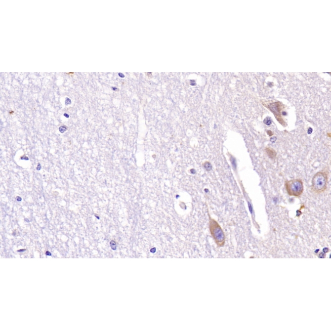 Acetylcholinesterase (ACHE) Human Monoclonal Antibody