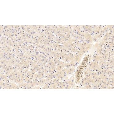 Acetylcholinesterase (ACHE) Human Monoclonal Antibody