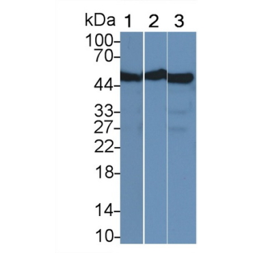 Enolase 1 (ENO1) Human Monoclonal Antibody