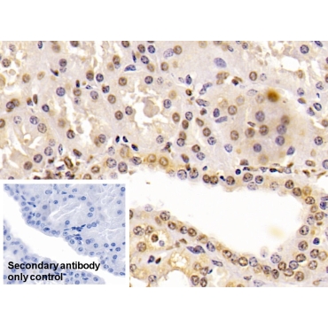 Enolase 1 (ENO1) Human Monoclonal Antibody