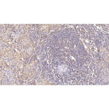 Azurocidin (AZU) Human Monoclonal Antibody