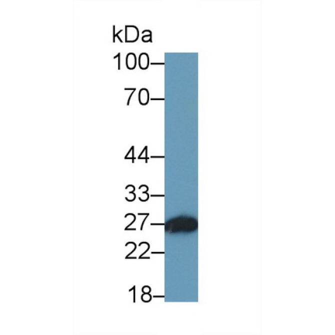 Azurocidin (AZU) Human Monoclonal Antibody