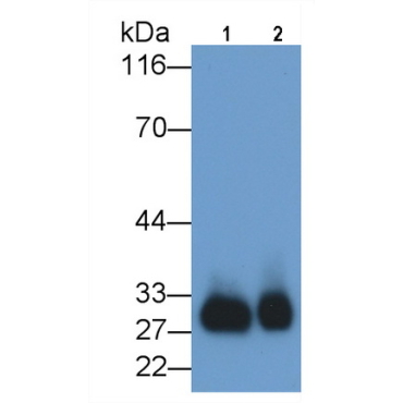 Azurocidin (AZU) Human Monoclonal Antibody
