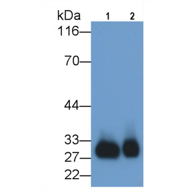 Azurocidin (AZU) Human Monoclonal Antibody