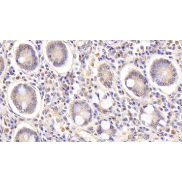Heparin Binding Epidermal Growth Factor Like Growth Factor (HBEGF) Human Monoclonal Antibody