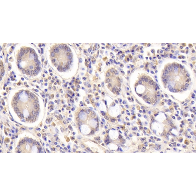 Heparin Binding Epidermal Growth Factor Like Growth Factor (HBEGF) Human Monoclonal Antibody