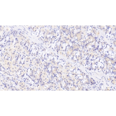 Heparin Binding Epidermal Growth Factor Like Growth Factor (HBEGF) Human Monoclonal Antibody