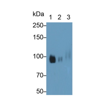 Colony Stimulating Factor Receptor, Macrophage (MCSFR) Human Monoclonal Antibody
