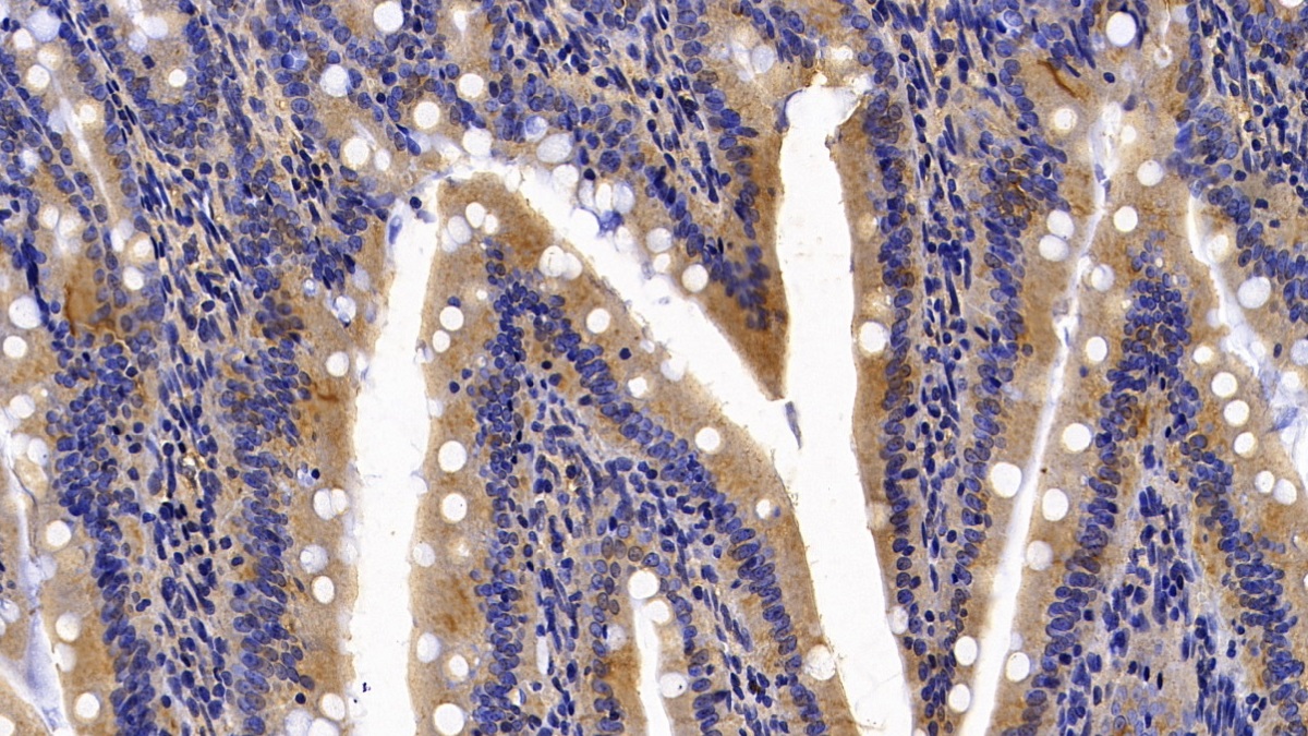 Calreticulin (CALR) Rat Monoclonal Antibody