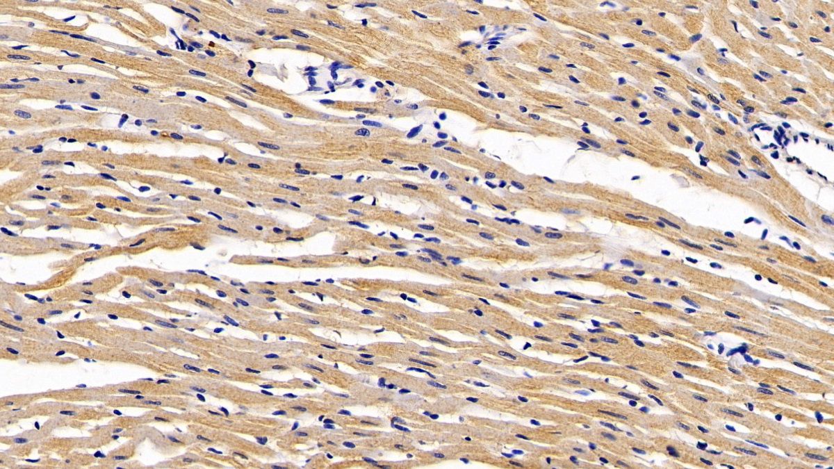 Calreticulin (CALR) Rat Monoclonal Antibody