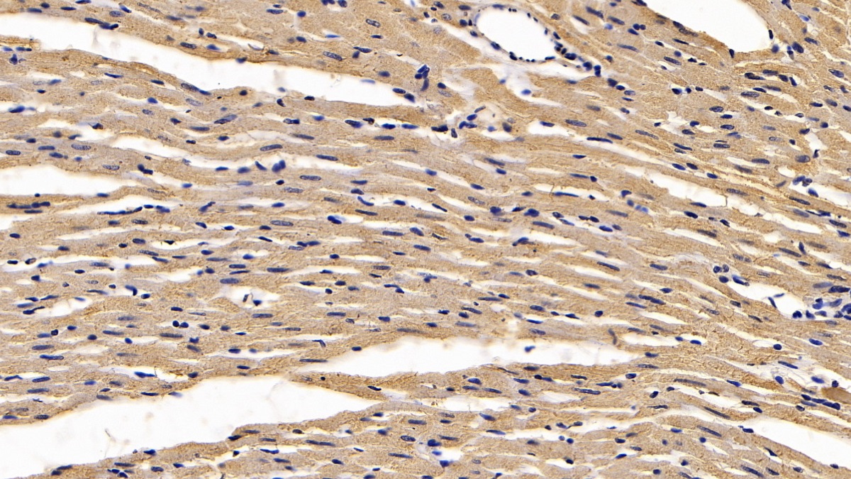Calreticulin (CALR) Rat Monoclonal Antibody