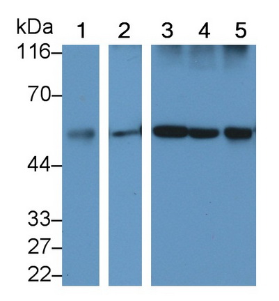 Calreticulin (CALR) Rat Monoclonal Antibody