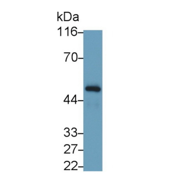 Interferon Gamma Receptor 1 (IFNgR1) Human Monoclonal Antibody