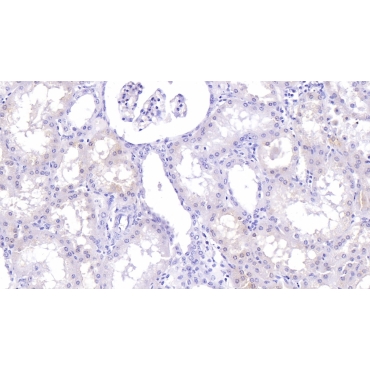 Lumican (LUM) Human Monoclonal Antibody