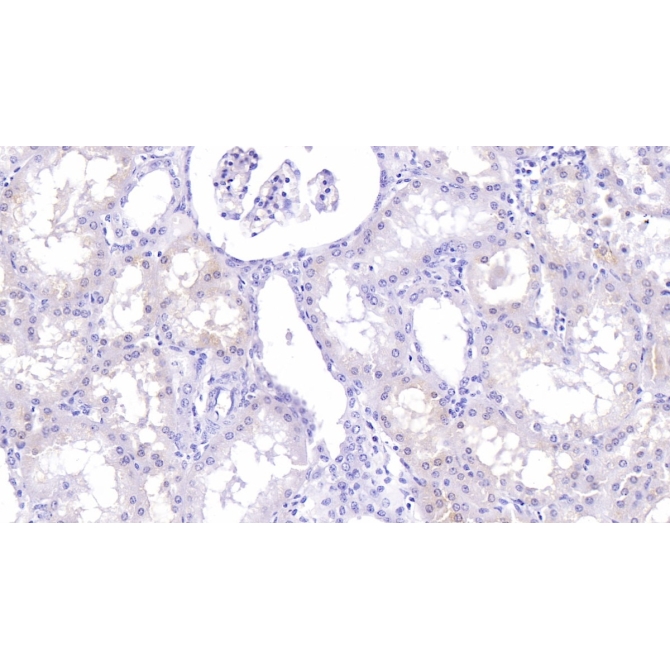 Lumican (LUM) Human Monoclonal Antibody